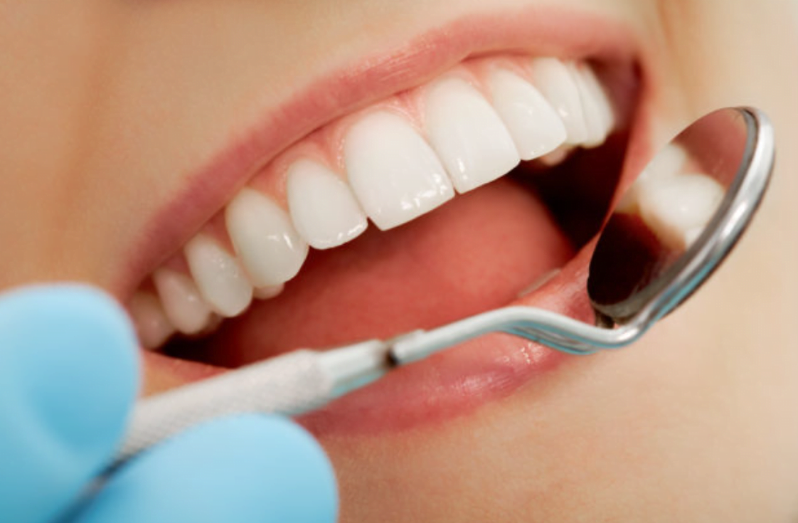 dental filling charges