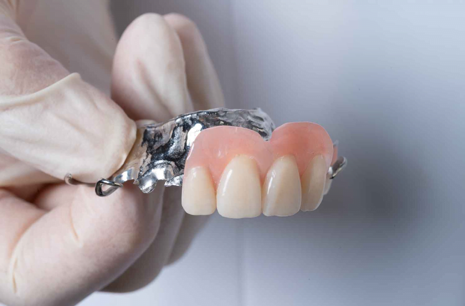 partial denture front teeth