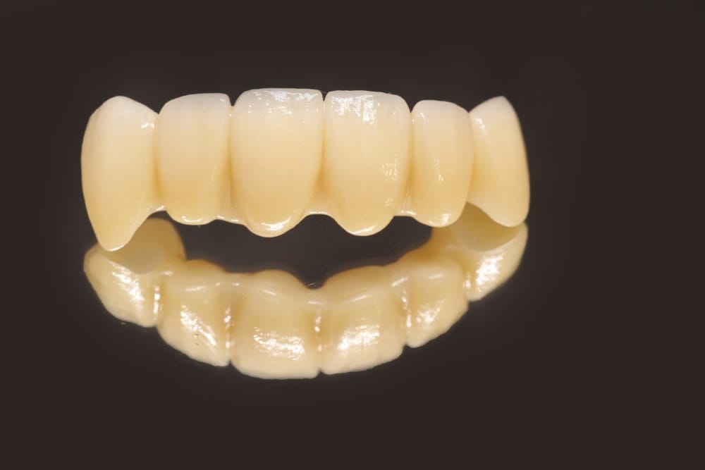 pictures of partial dentures front teeth