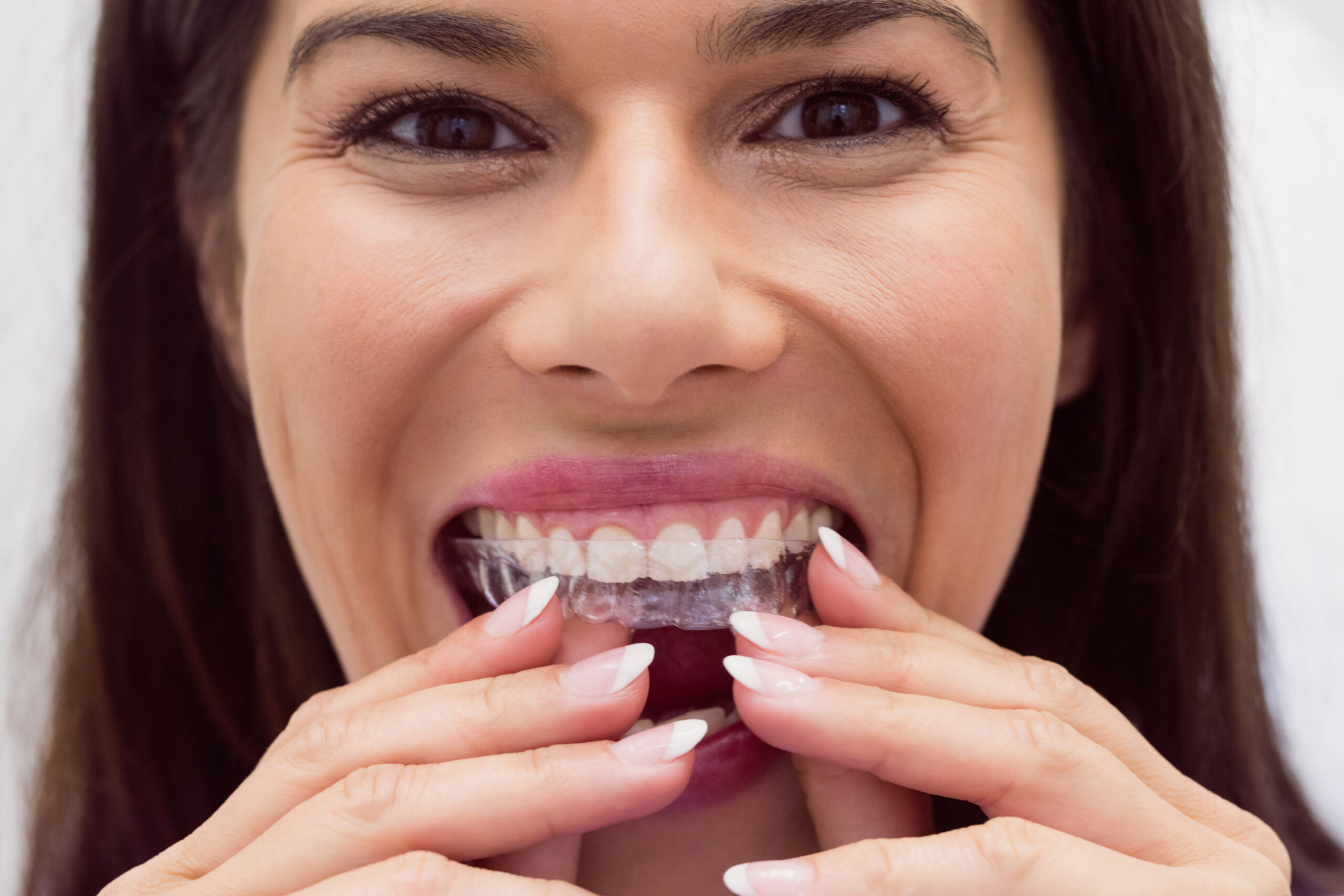 Best Invisalign Dentist Markham