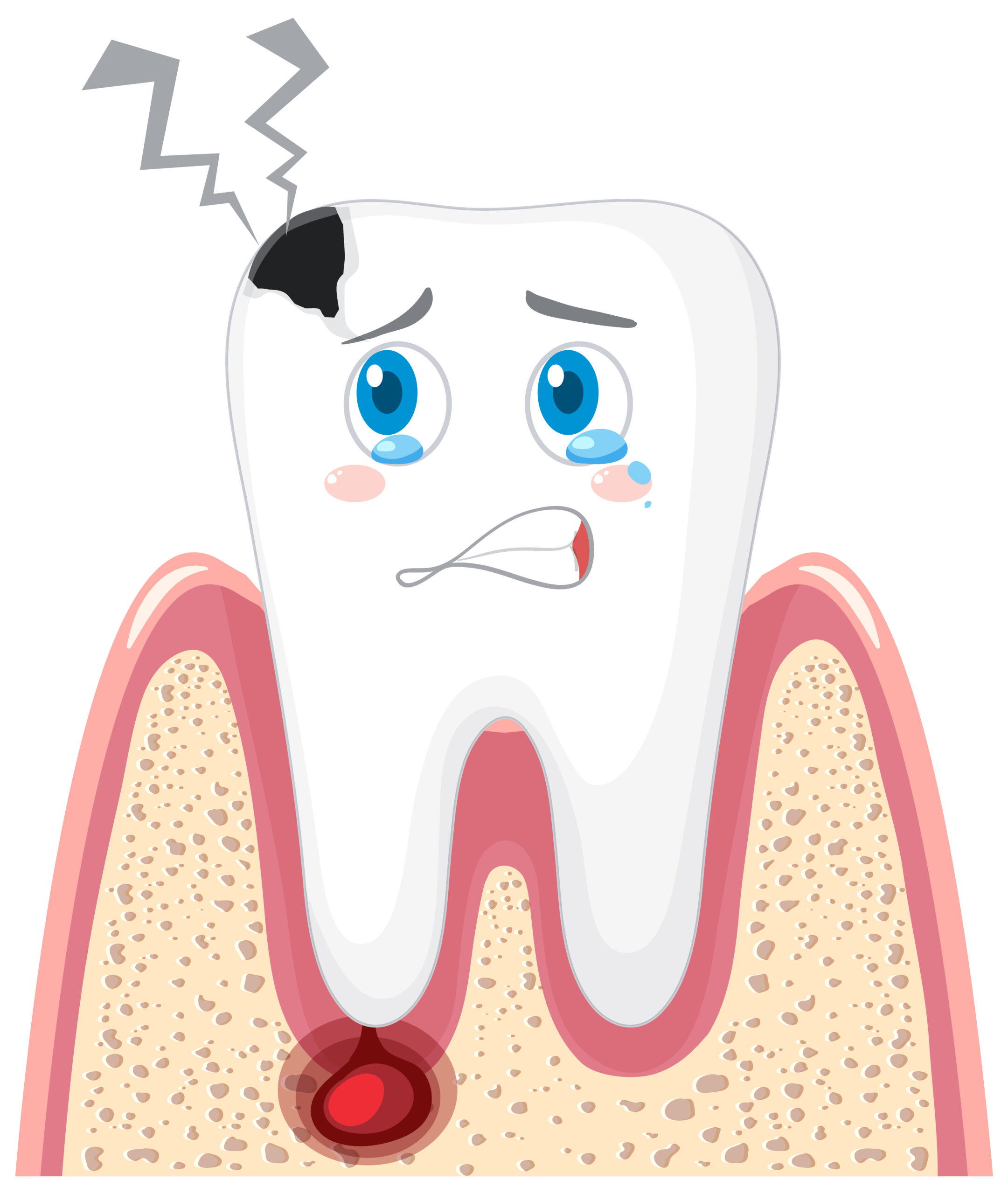 Gum Disease Treatment in Markham