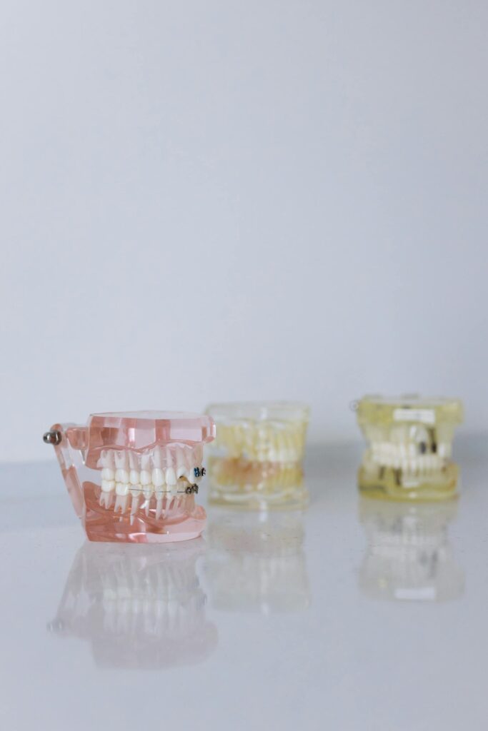 Complete dentures fitting in Markham at Armadale Dental